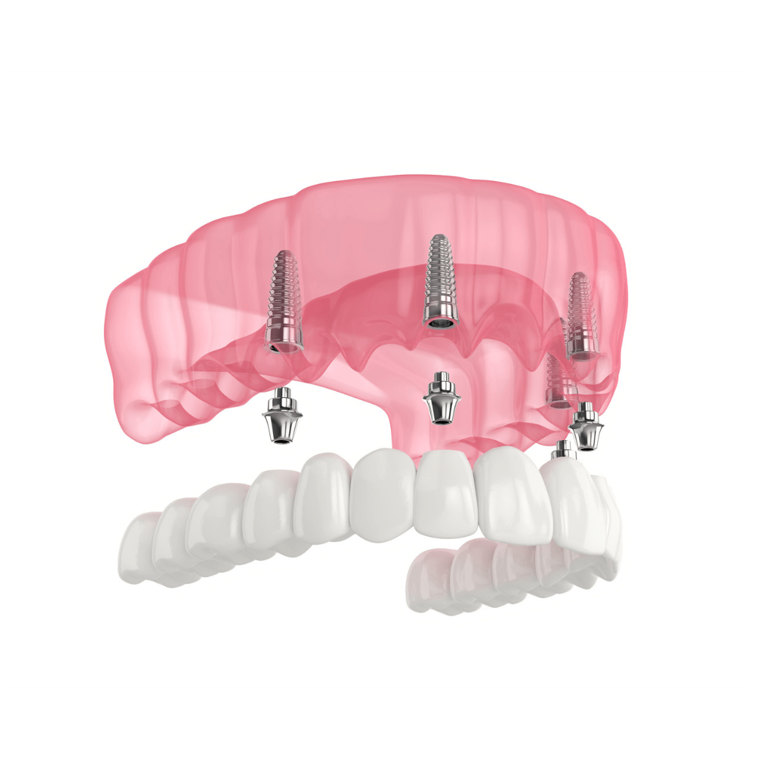 Servizi Dentali in Albania