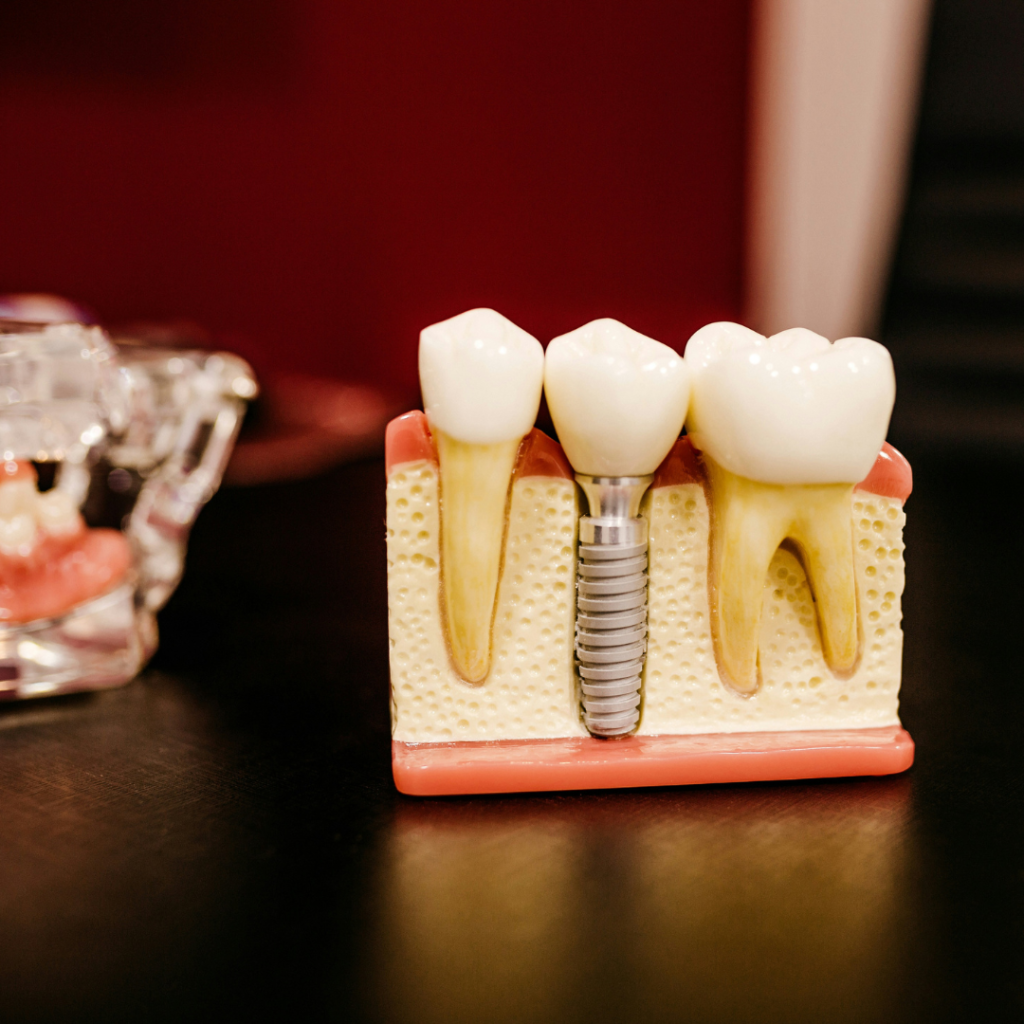 Dental Services in Albania