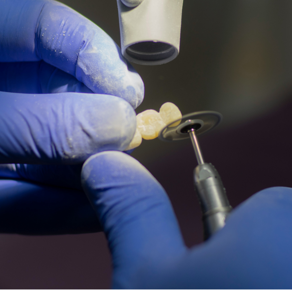 Dental Services in Albania