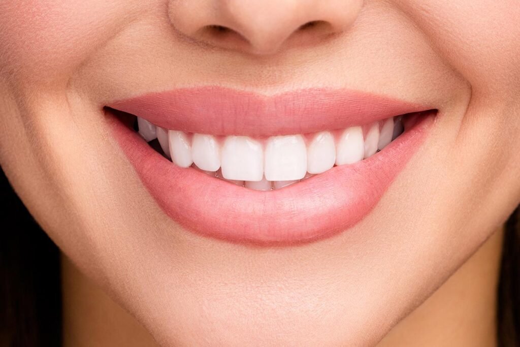 Hollywood Smile in Albania