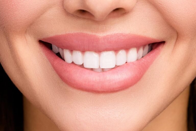 Hollywood Smile in Albania