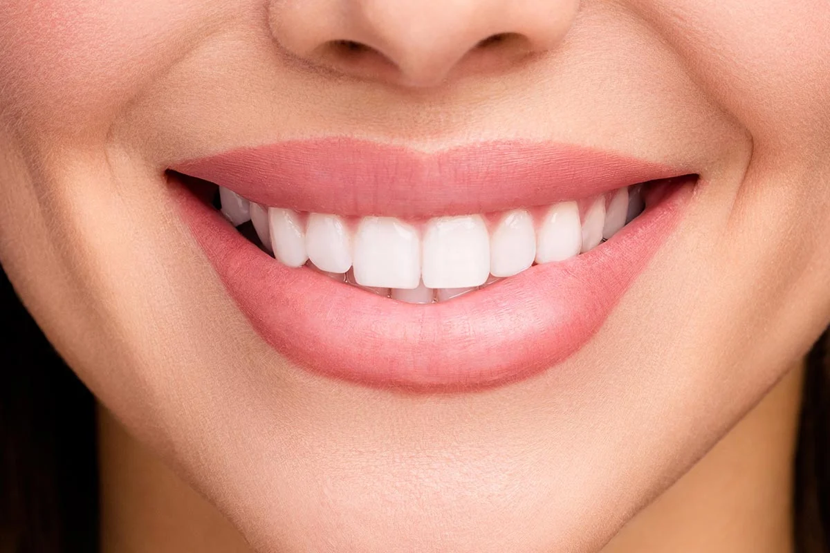 servizi dentali in albania