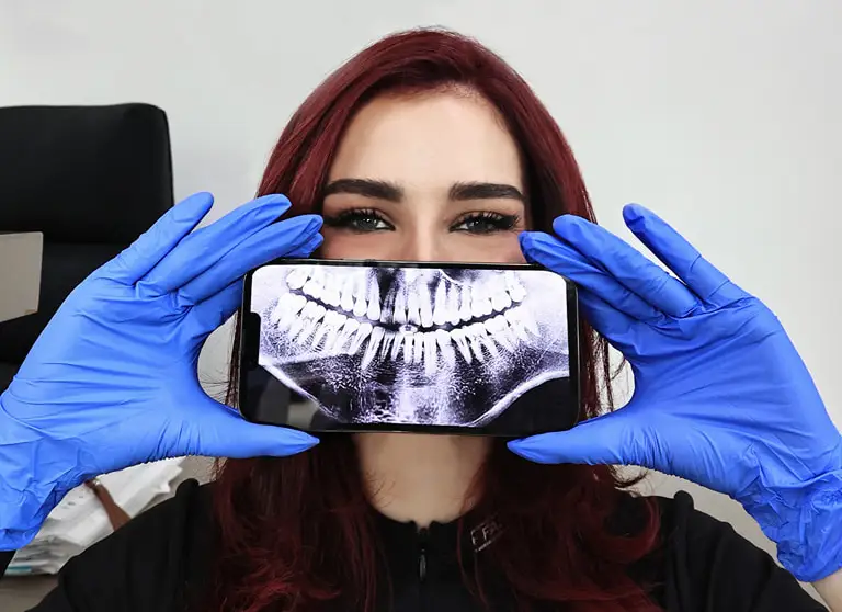 Kostoja e Implanteve Dentare