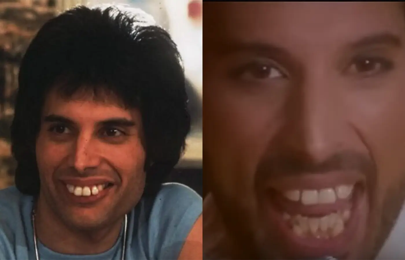 Freddie Mercury Denti