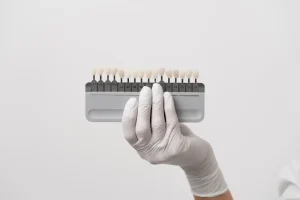 costo faccette dentali