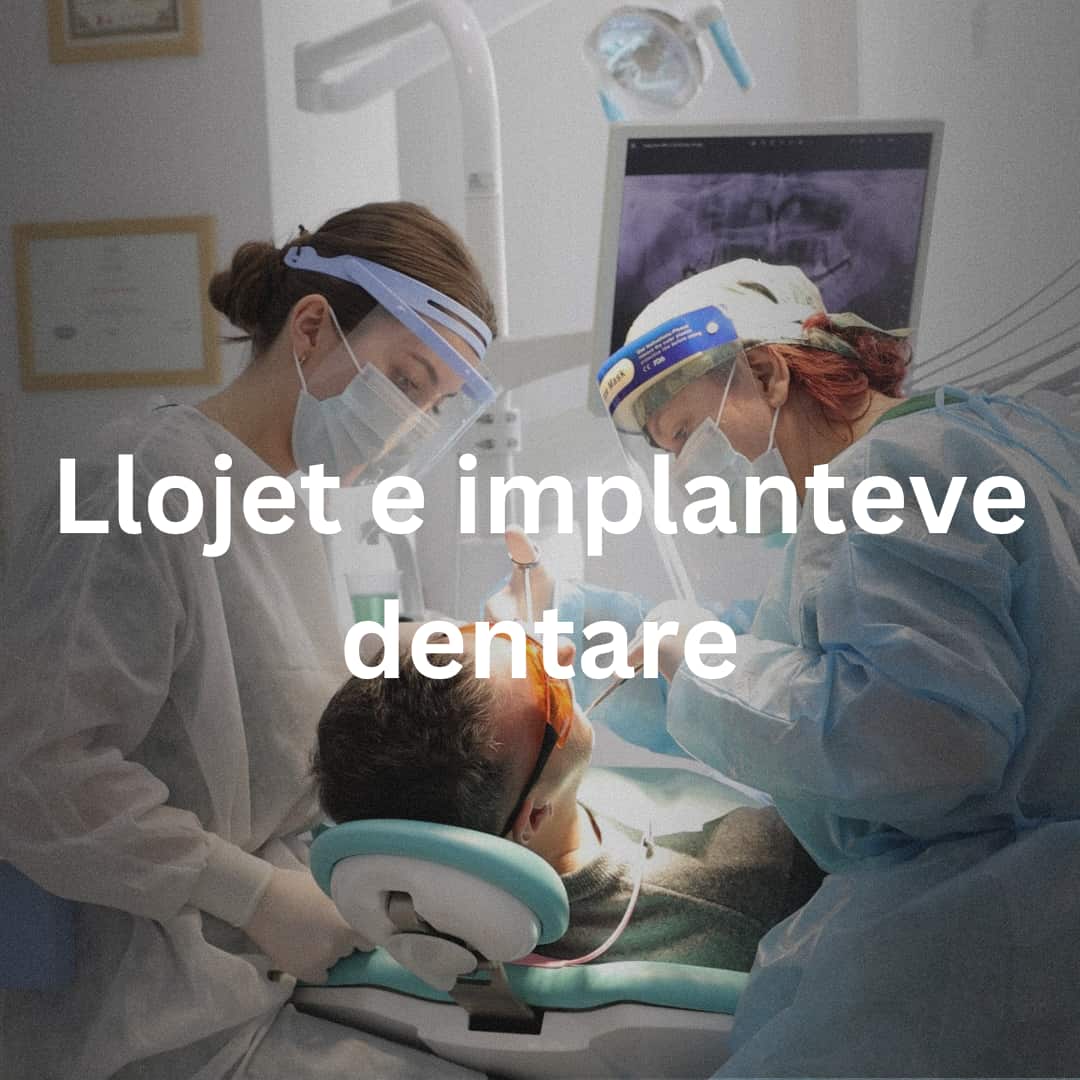Llojet e implanteve dentare
