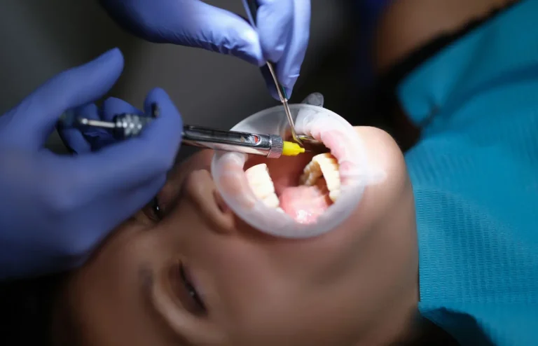 quanto dura anestesia dentista