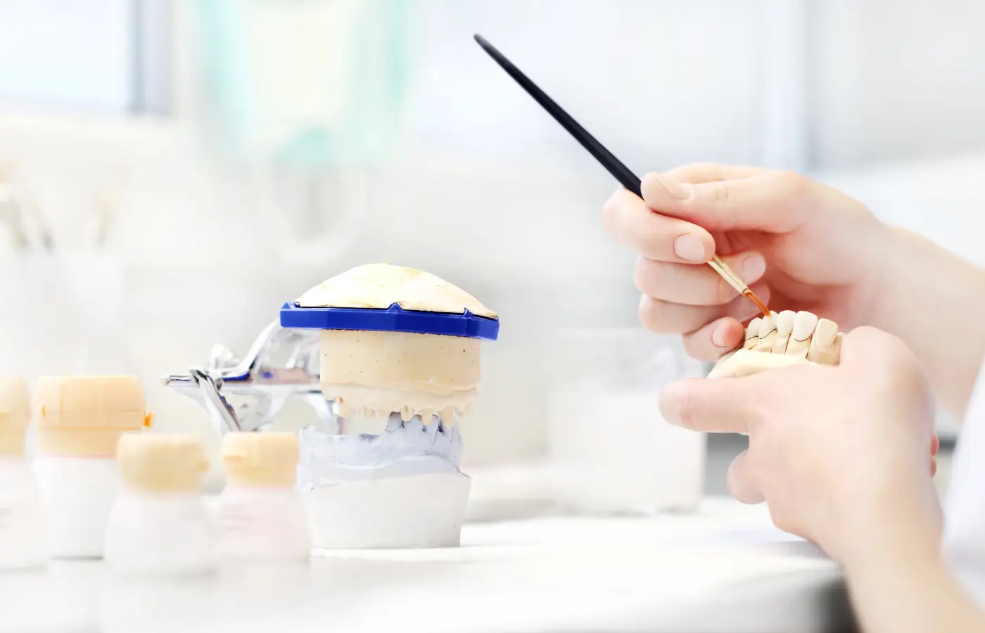 Quali sono i costi delle capsule dentali