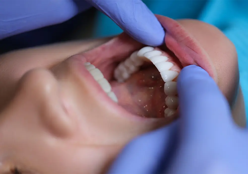 Impianto Dentale e Dolore