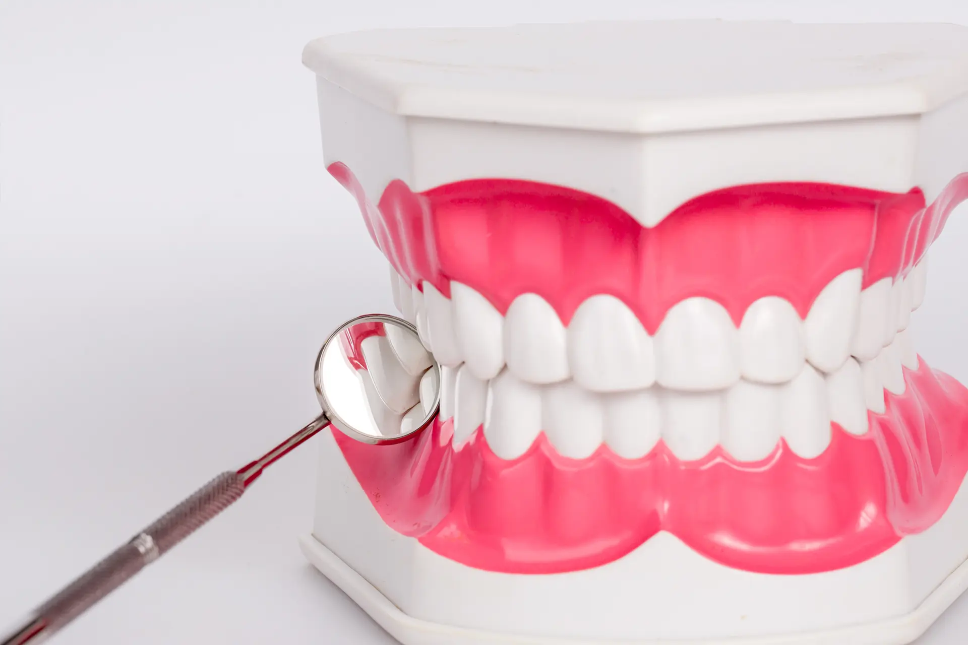 Denti Fissi Arcata Superiore