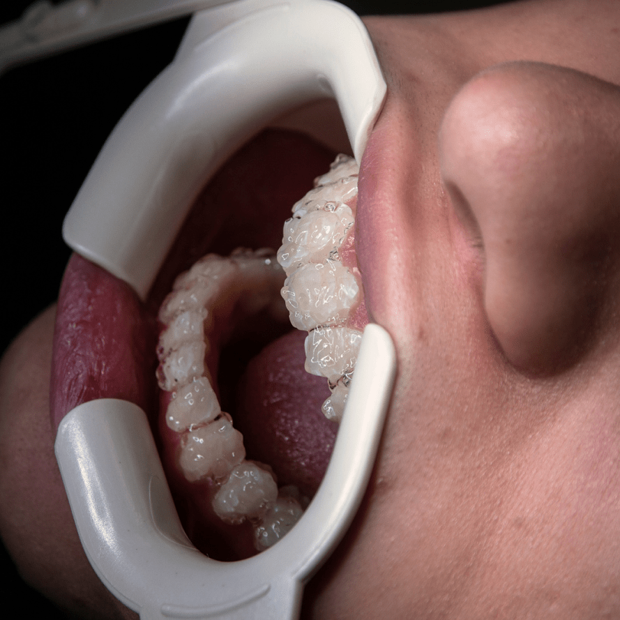 Servicios dentales en Albania