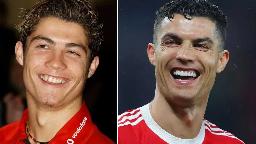 Cristiano Ronaldo teeth